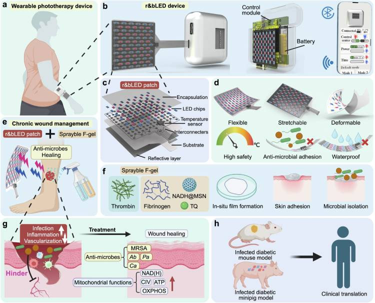 Fig. 1: A wearable r&bLED patch combined with sprayable fibrin gel for wound treatment.